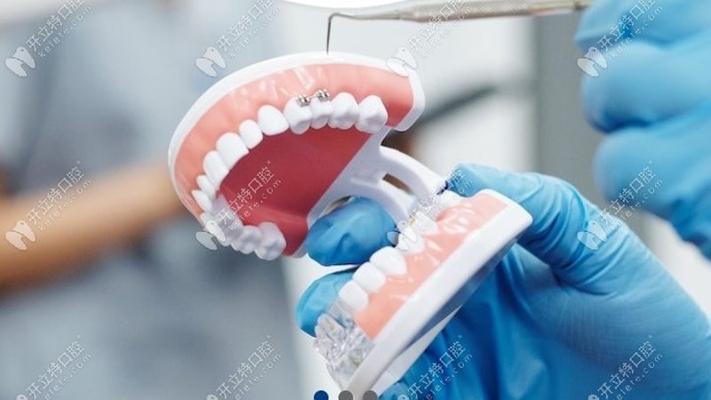 烤瓷牙代理区域保护政策：了解其背后的意义与影响**